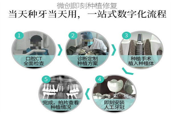 全新普陀区牙科医院种植牙价格表：单颗2500+半口1.8万+全口3.6万+