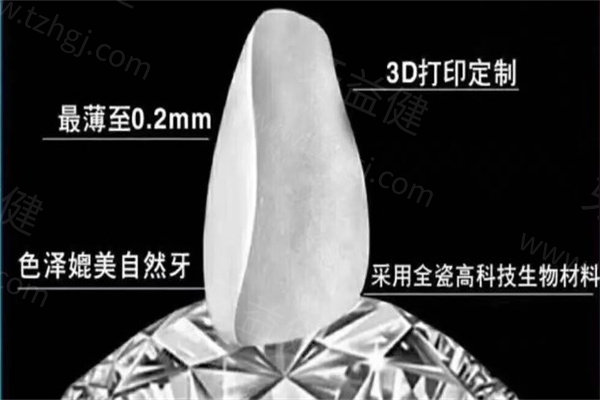 广州牙贴面价格2025新版出炉:树脂贴面680起/全瓷贴面2300起附正规口碑牙科医院名单