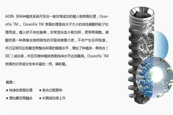 雅定种植牙是哪国的品牌？是以色列出名品牌价格不贵性能好寿命可达20年+