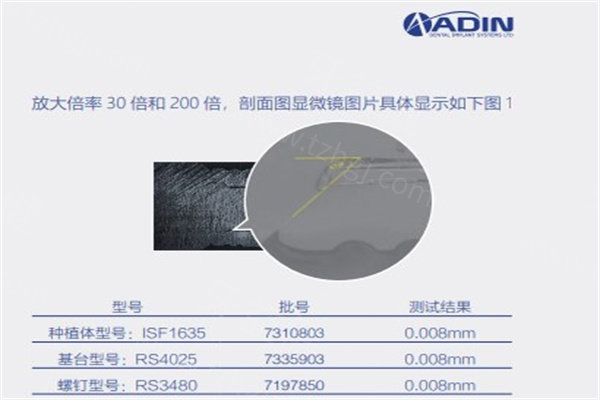 雅定种植牙是哪国的品牌？是以色列出名品牌价格不贵性能好寿命可达20年+