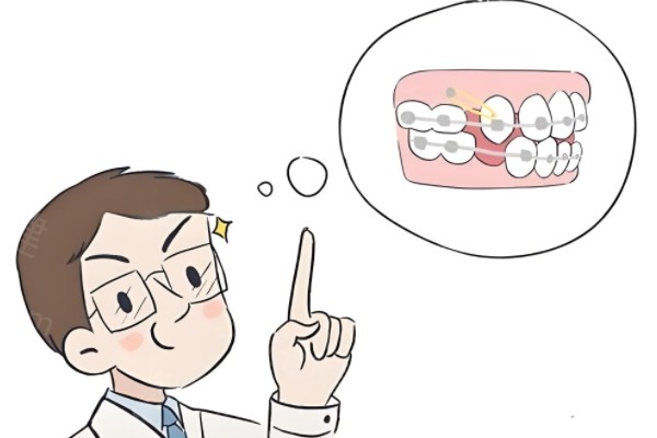 福州活动义齿费用是多少
