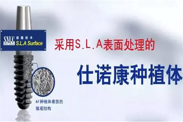 集采种植牙品牌有哪些?盘点常用种植体品牌/价格/使用寿命
