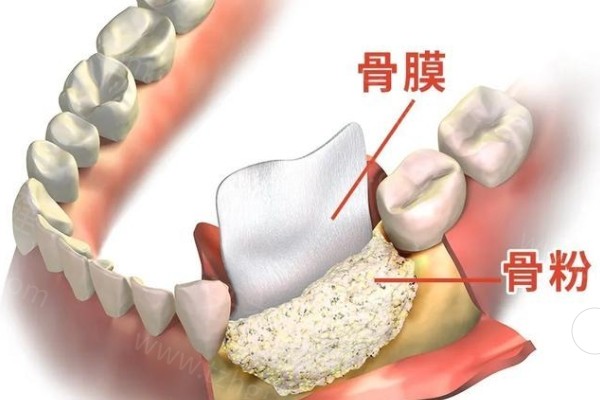 长春牙科收费价目表