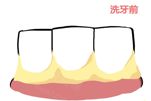 很多牙友在后台留言想了解济南口腔医院的收费情况，今天小编就为大家整理了一份2025济南口腔医院价目表。需要提醒的是，实际收费会根据个人牙齿情况、医生级别以及优惠活动有所浮动，以下价格仅供参考哦~