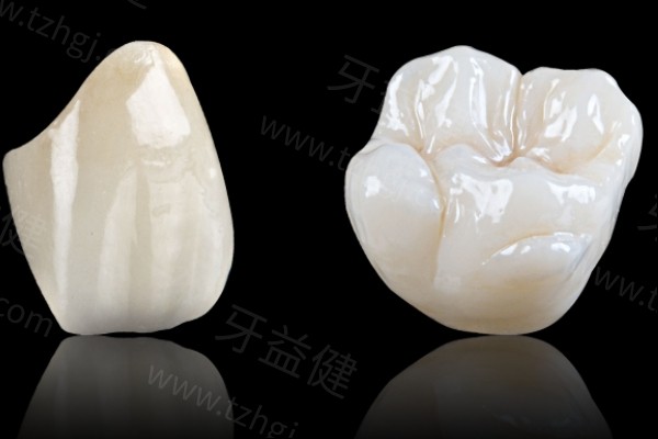 德国威兰德全瓷牙冠价格表在线查询