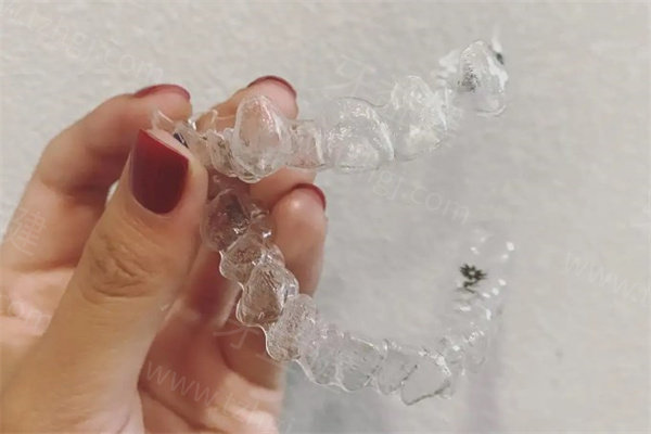 牙齿矫正如何选择合?其实根据脸型/年龄/费用就能制定专属方案