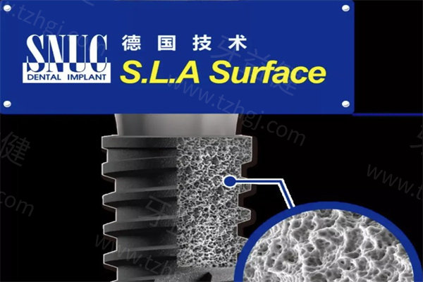 种植牙种八颗多少钱?价格表显示种8颗费用从3万-20万不等