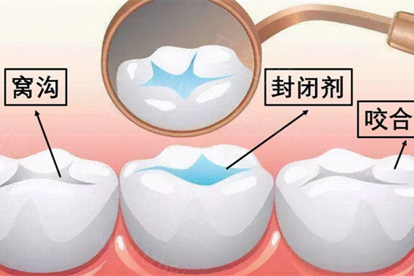 重庆牙科医院收费价目表