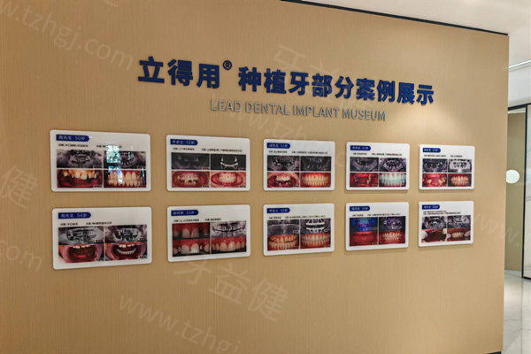 中诺口腔医院价格体系：透明化收费