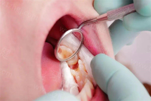 南京康贝佳口腔医院收费标准 南京康贝佳口腔医院收费标准